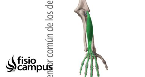 Infografía comparando la ubicación del extensor con y sin obstáculos