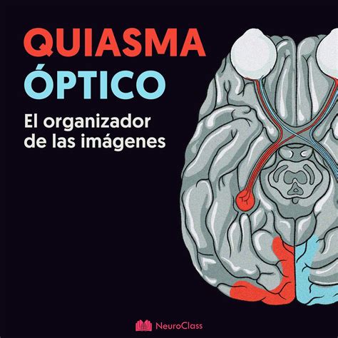 Ilustración de la decusación de fibras en el quiasma óptico